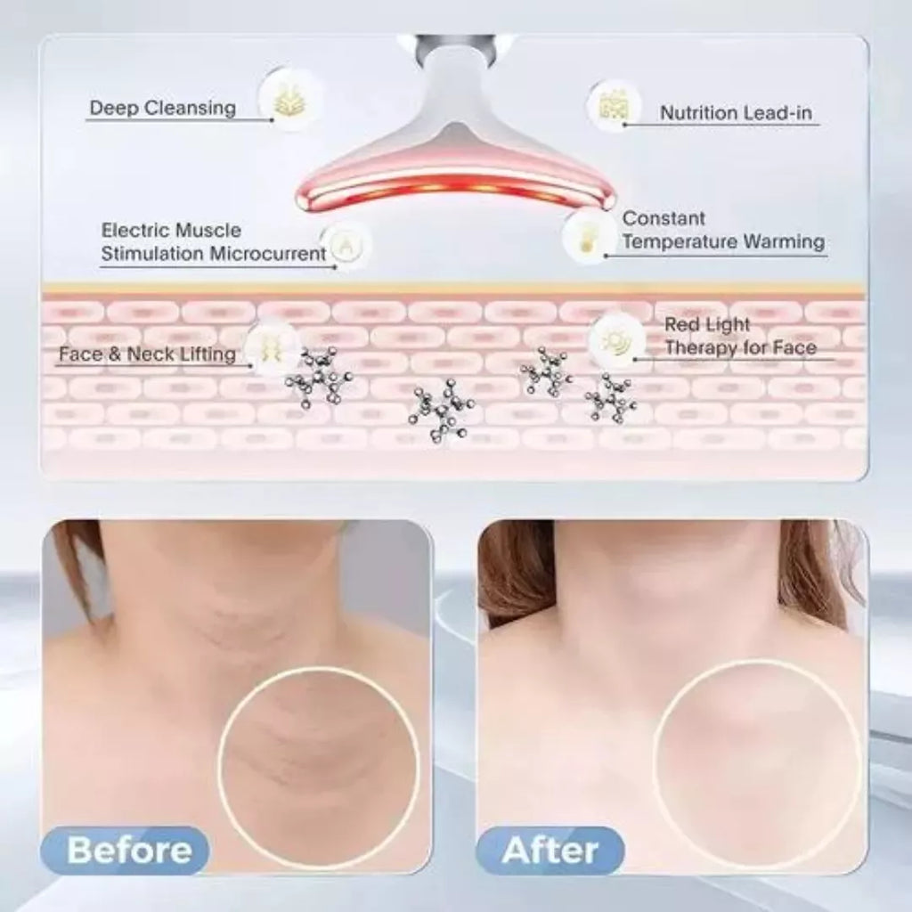 ✨ Lifting Facial en Casa – Masajeador de Papada con Calor Infrarrojo